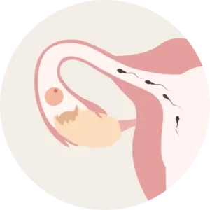 Pametni prstan Femometer med spanjem meri bazalno temperaturo in natančno prepozna plodne dni.